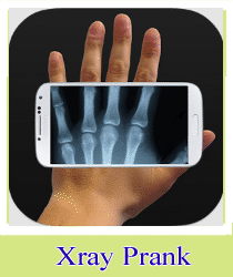 Xray%2BPrank.gif