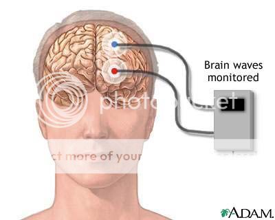 brain-wave-monitor.jpg